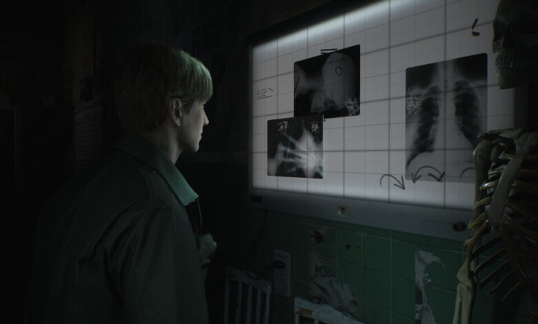 ظهور-مجموعة-من-الصور-لريميك-silent-hill-2-يعتقد-بأنه-تم-تسريبها!-–-العاب-–-يلا-لايف